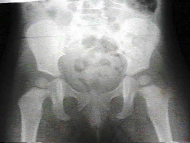 x ray pediatrics